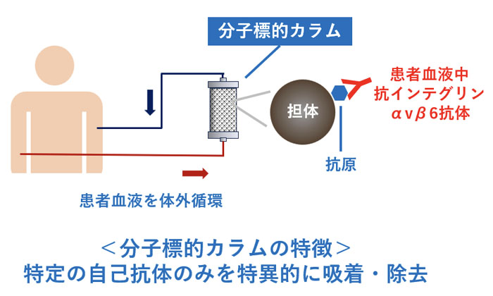 Image of treatment with molecularly targeted columns