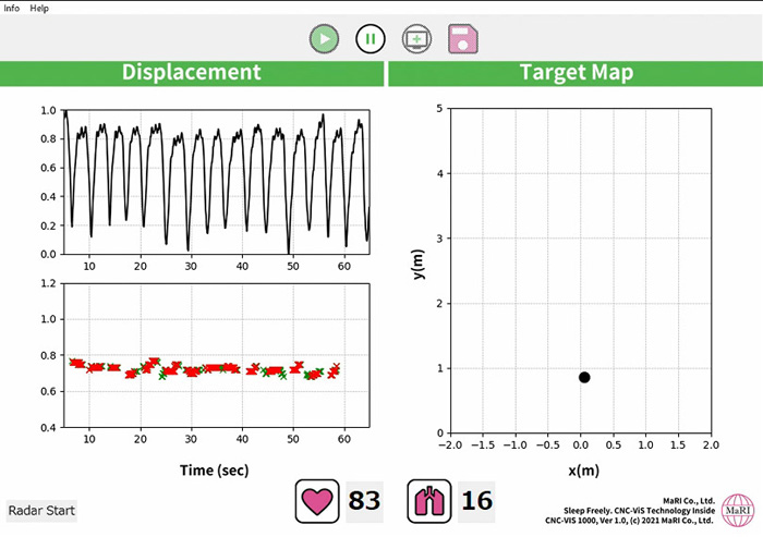 A view of the screen during data acquisition